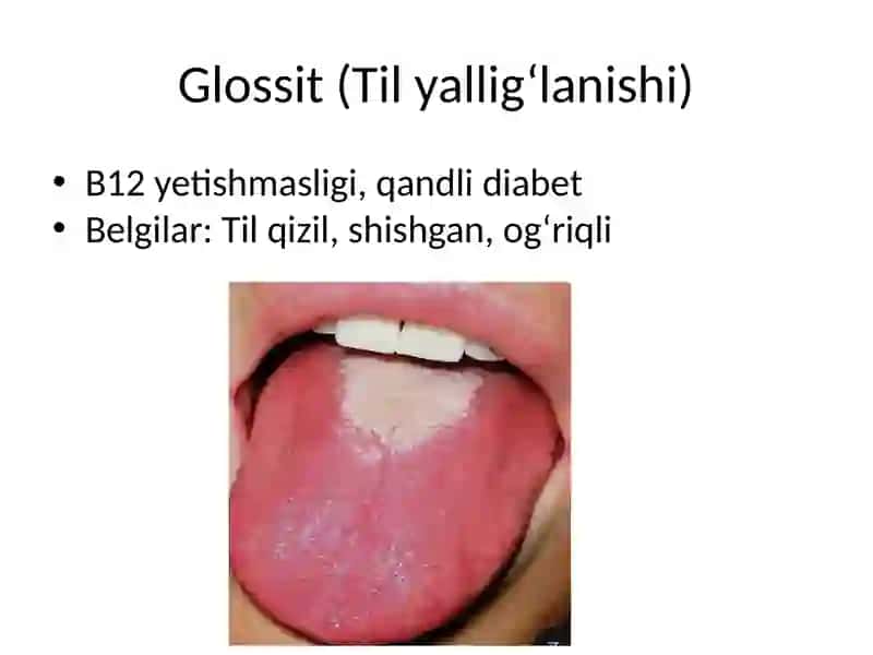 Endokrin kasalliklarda og‘iz bo‘shlig‘ida kuzatiladigan o‘zgarishlar va dispanserizatsiya 3