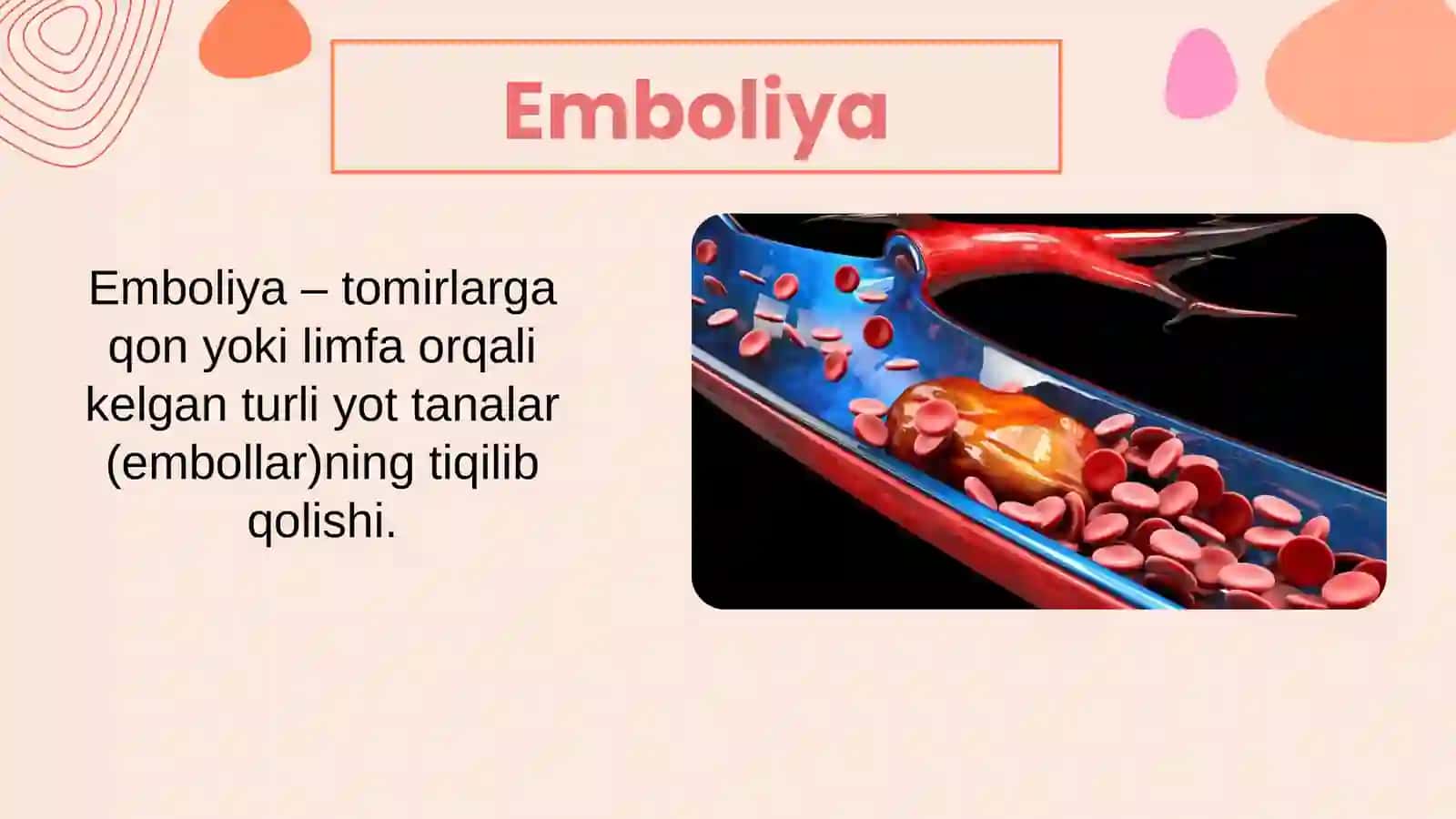 Tromboemboliyalar va opka tromboemboliyasi 3