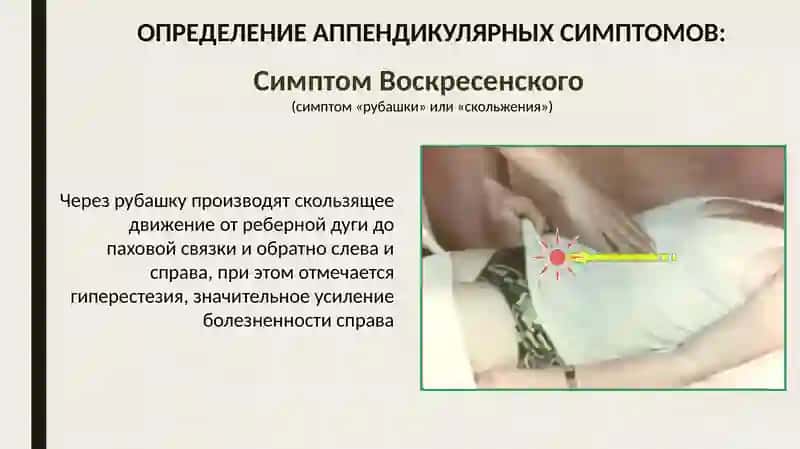 Ректальное исследование при тазовом аппендиците 3