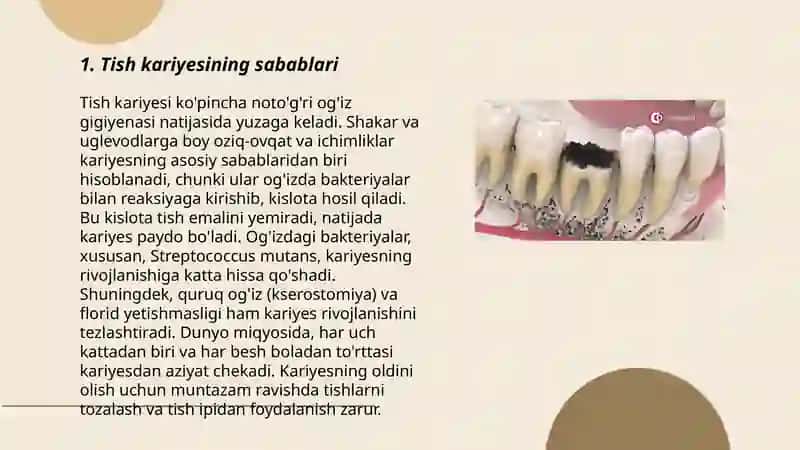 Tish kasalliklari: karies,pulpit,periodontit. 3