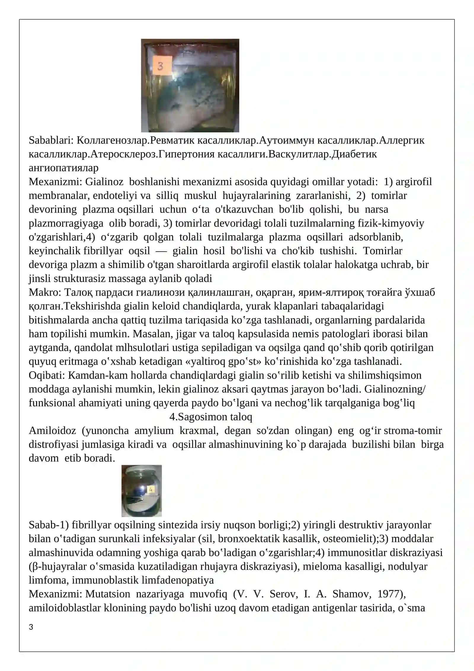 Til leykoplakiyasi -,,Oq til’’ Shilliq qavatlarning patologik muguzlanishi 3