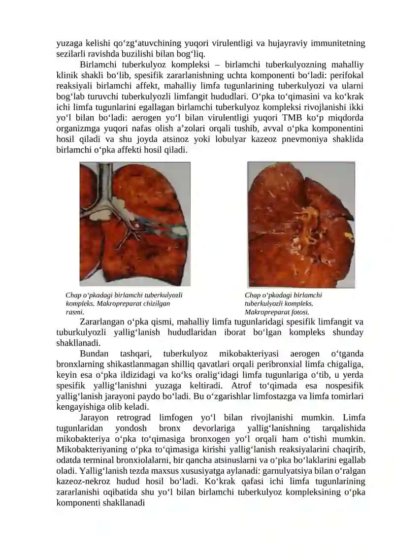 BIRLAMCHI TUBERKULYOZ 3