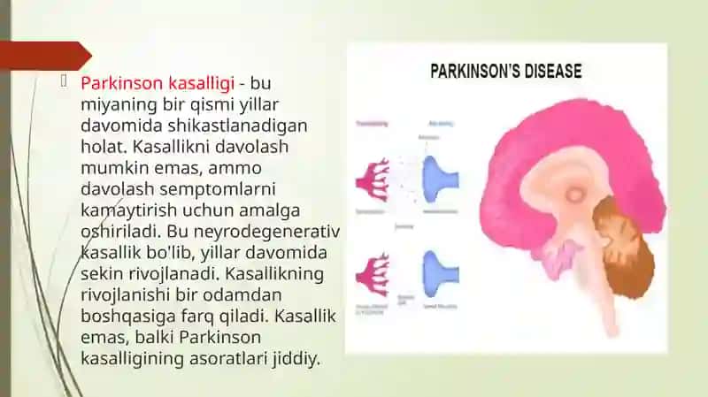 Parkinsonkasalligihaqidaumumiytushuncha 3