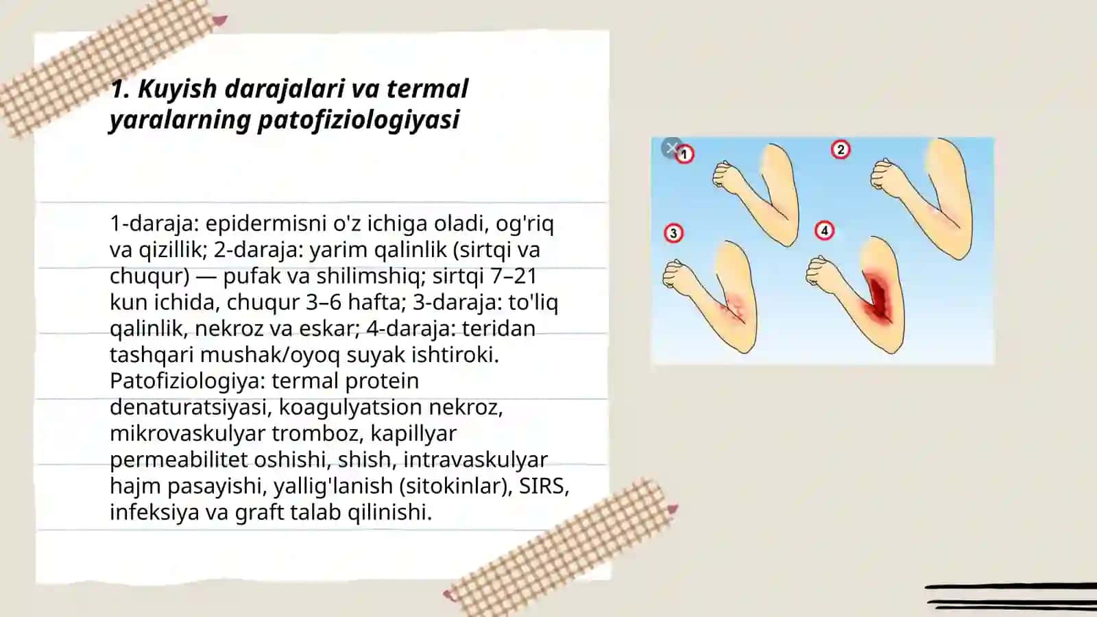 Kuyishni davolash. Erta nekrektomiya va avtodermoplastika 3