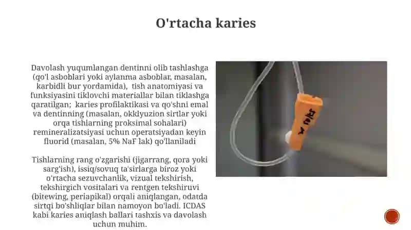 O'rtacha kariesni klinik kechishi va davolash 3