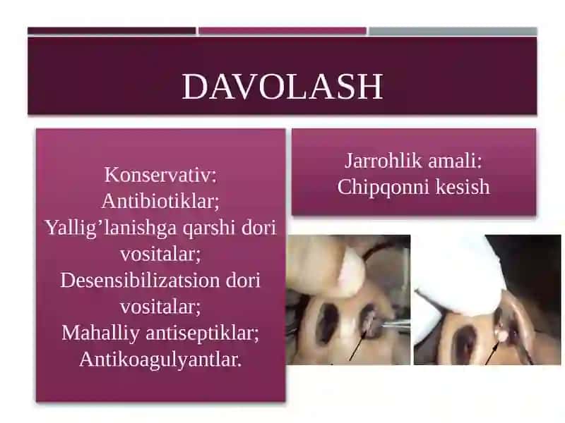 Otorinolaringologiyada shoshilinch Holatlar 3