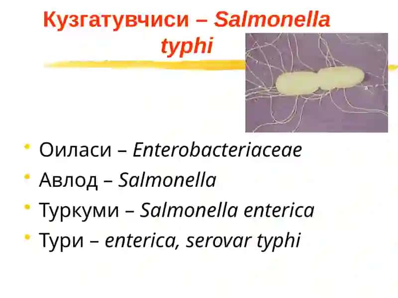 Ичтерлама–қорин тифи (typhusabdominalis) 3