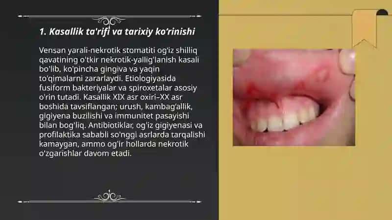 Vensan yarali-nekrotik stomatiti. Klinikasi. Tashxisi. Davolash 3