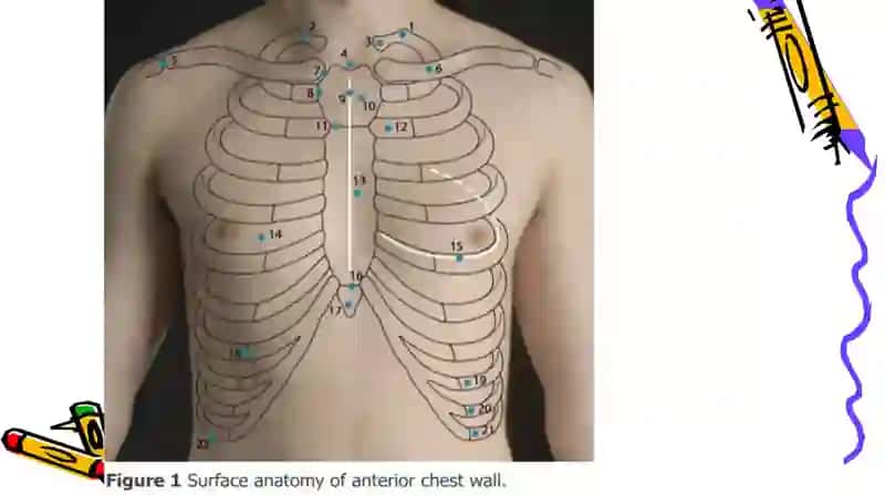 THE chest 3