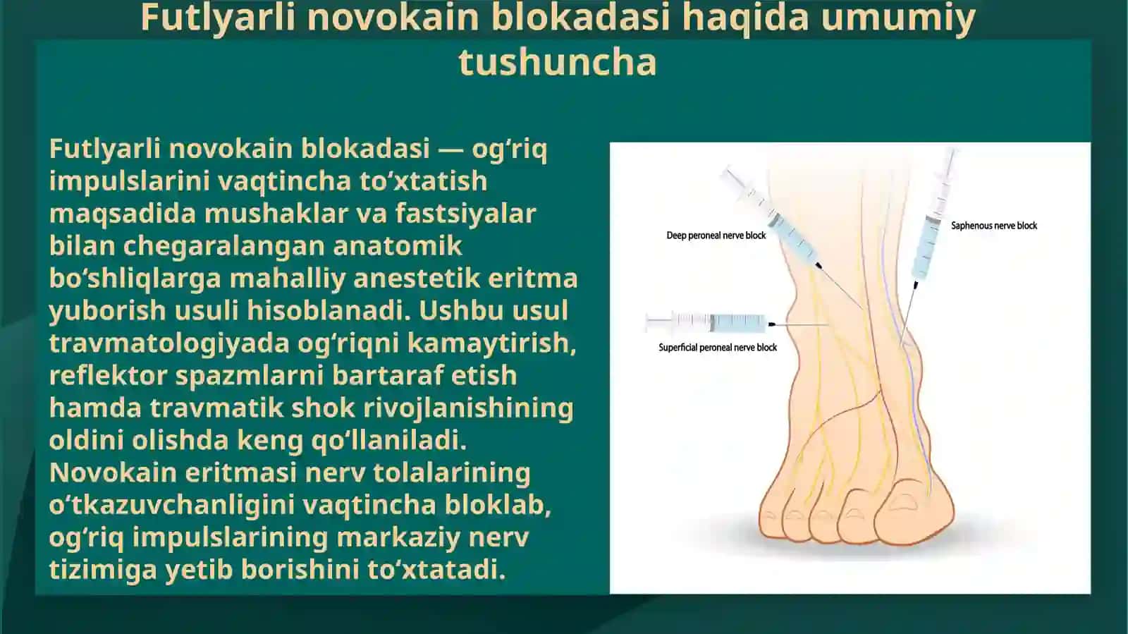 Futlyarli novokain blokadasining bajarilish texnikasi 3