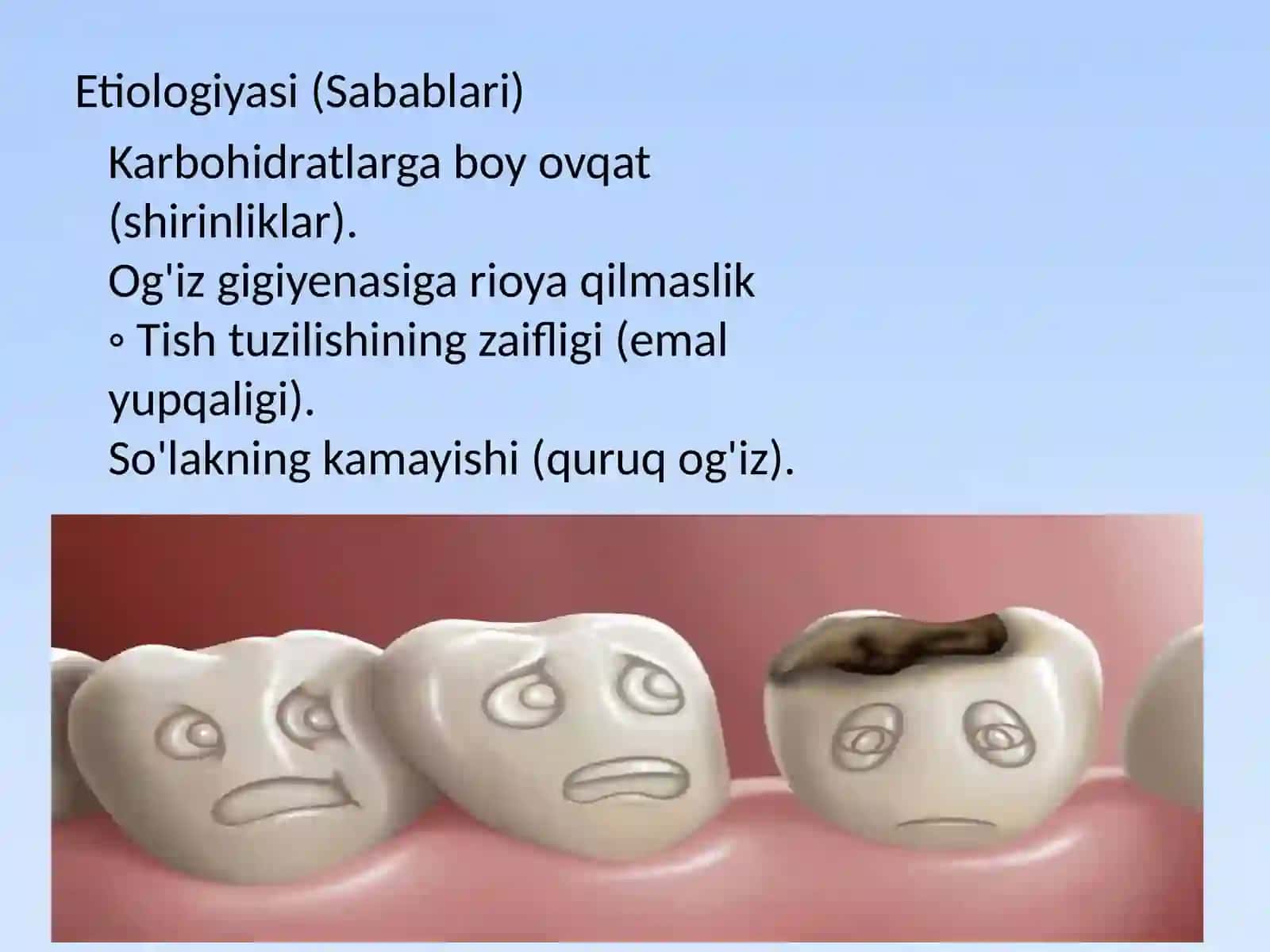 Karies, pulpit, periodontit. Klinikasi tashxisi va davolash 3