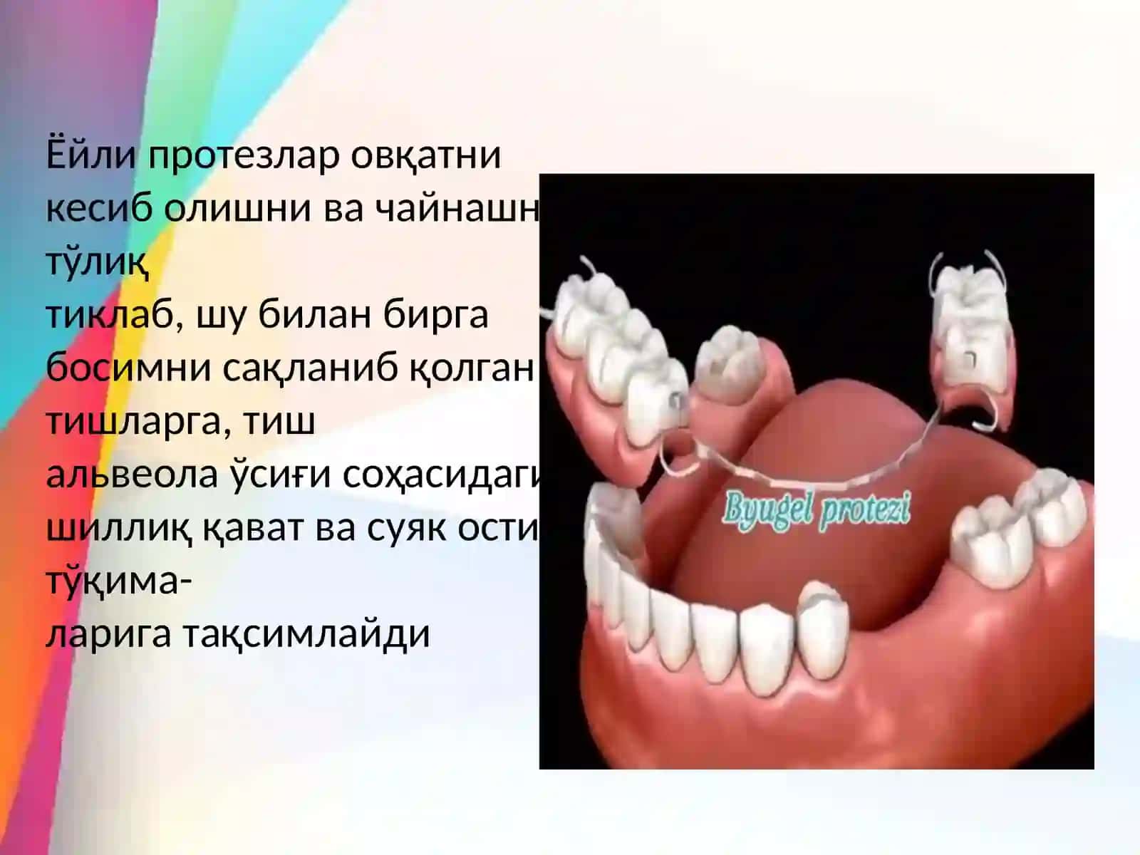 Ёйли протезларнинг ёй қисмий жойлашуви 3