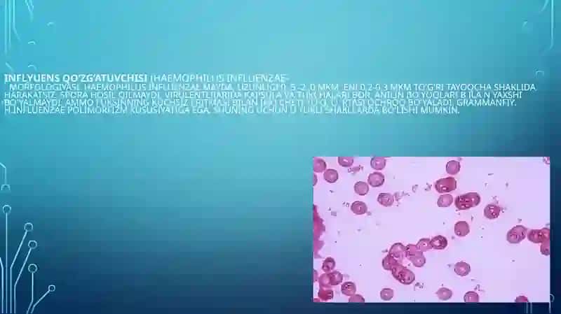 Haemophilus influenzae 3