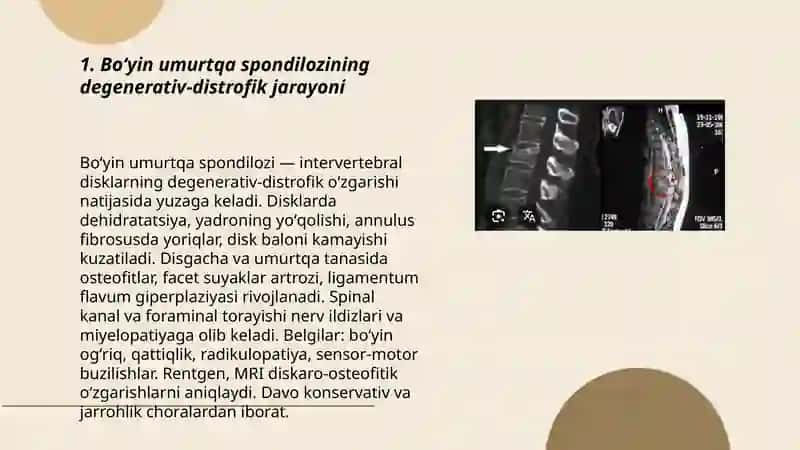 Umurtqa yallig‘lanish degenerativ-distrofik kasalliklari 3