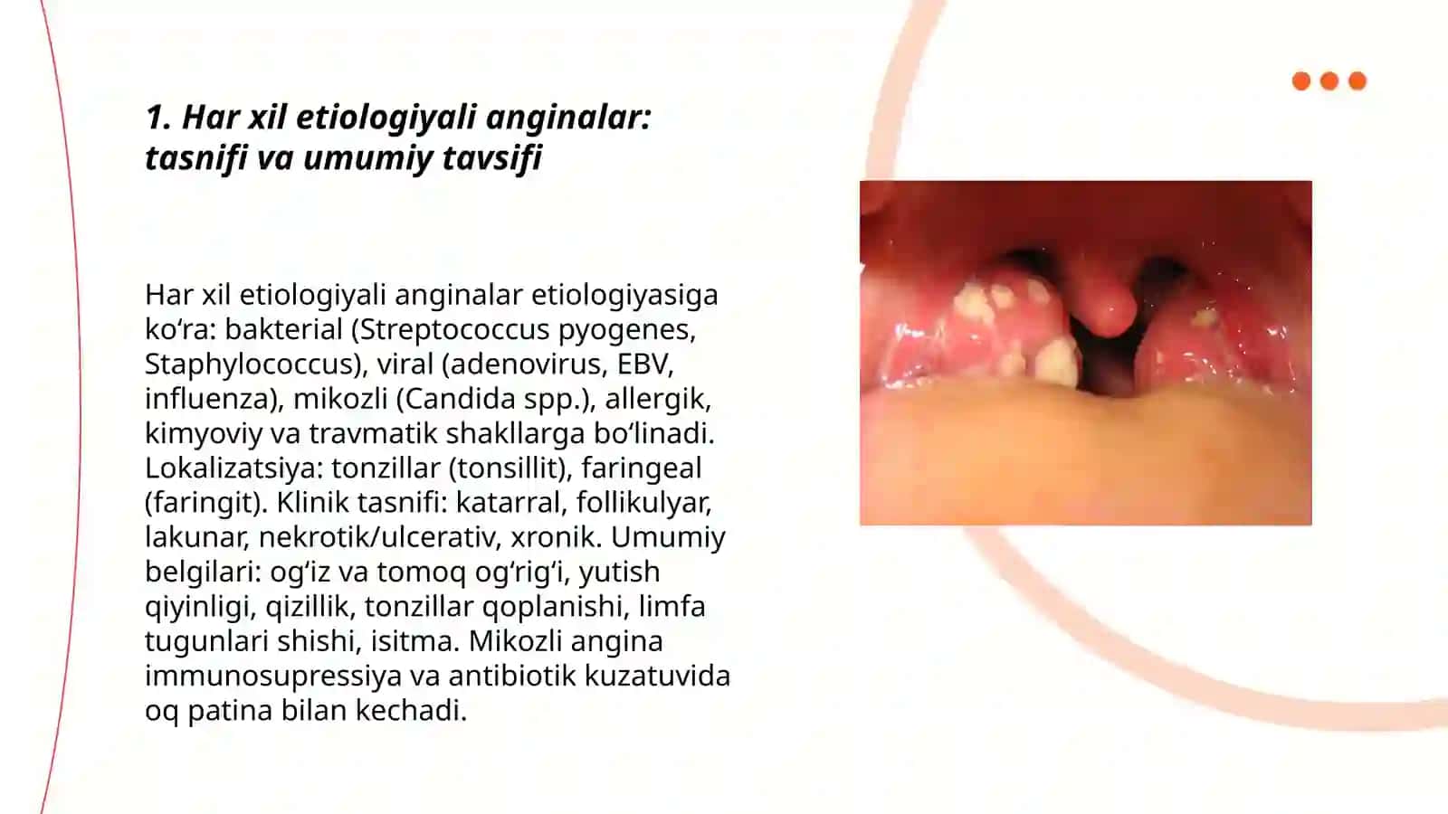 Har xil etiologiyali anginalar: tasnifi va umumiy tavsifi 3