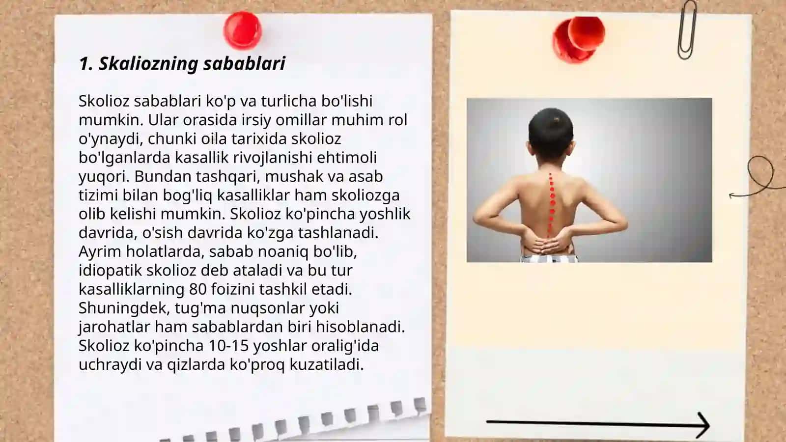 Skalioz kasalligi 3