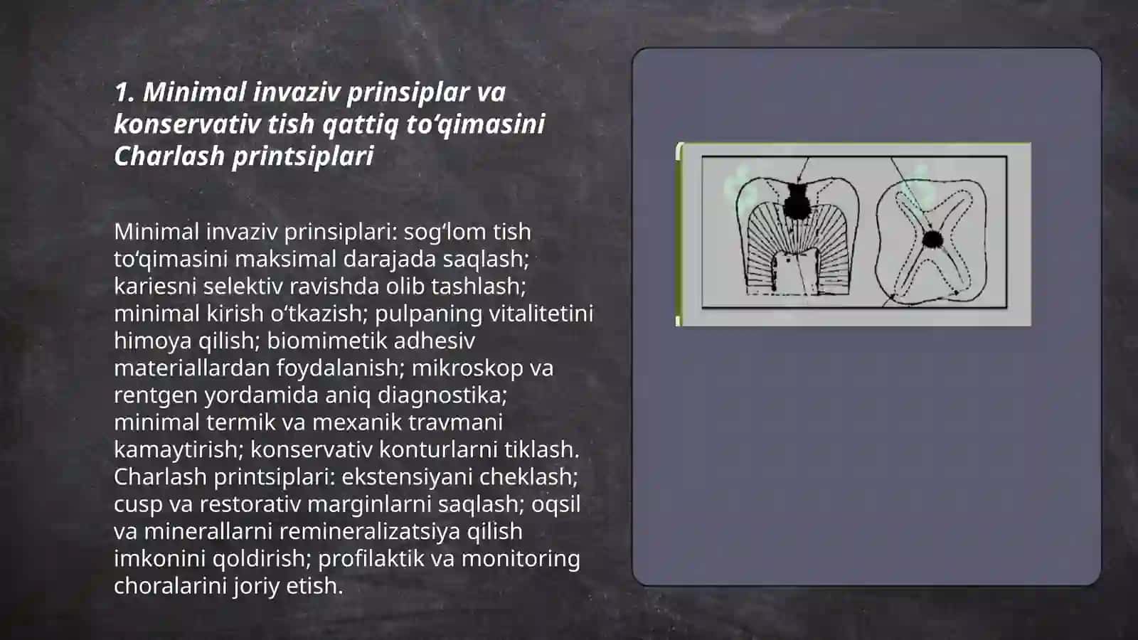 Tish qattiq to'qimasini Charxlashning minimal invaziv usulllar 3