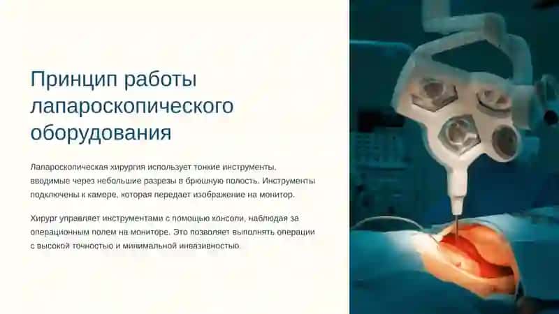 Лапароскопическая хирургия: инновационный подход в современной медицине 3