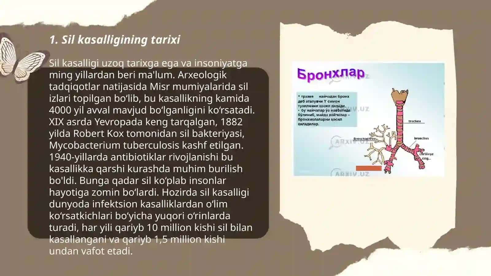 Sil kasalligi 3