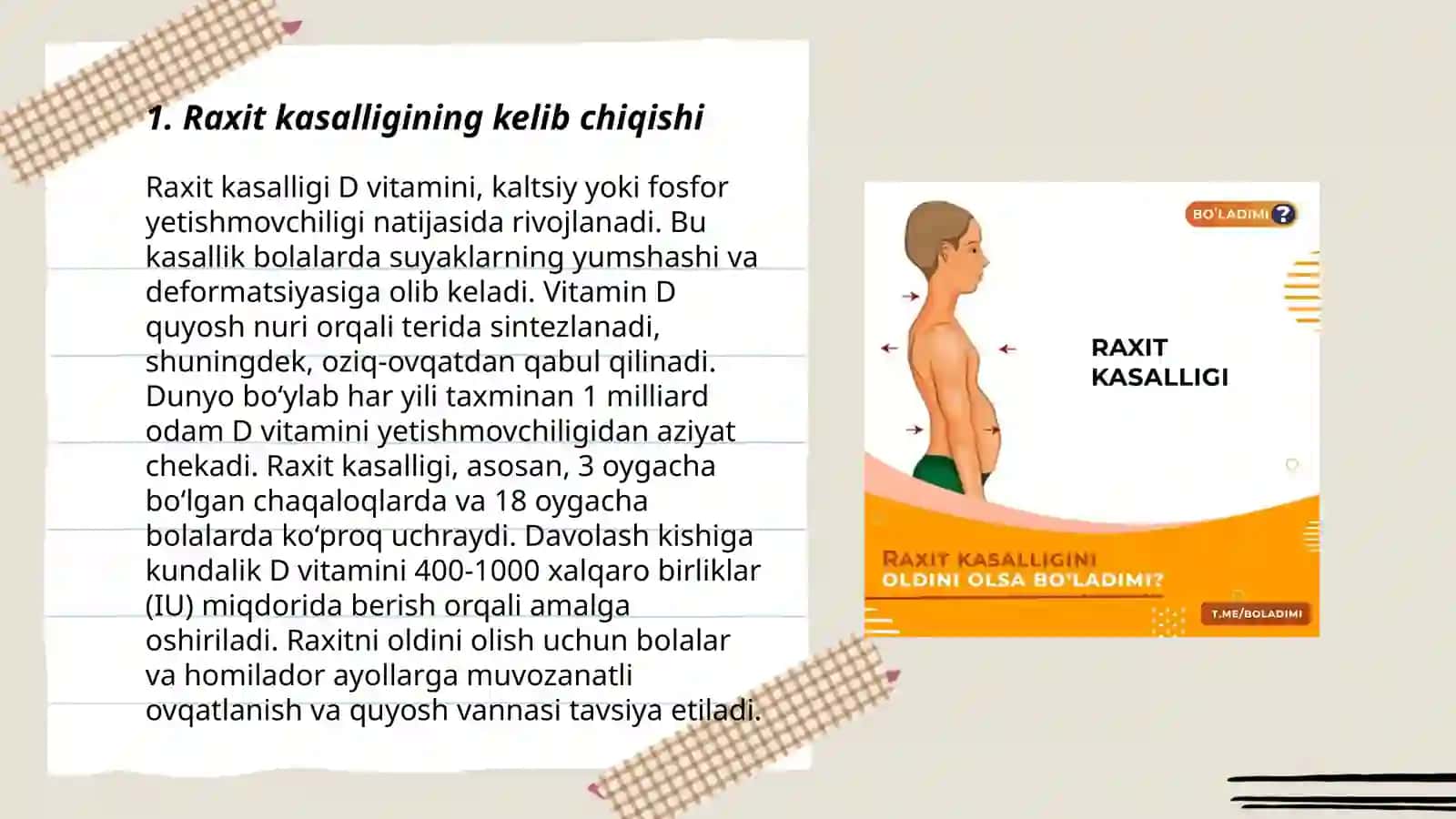 Raxit kasalligi haqida tushuncha 3