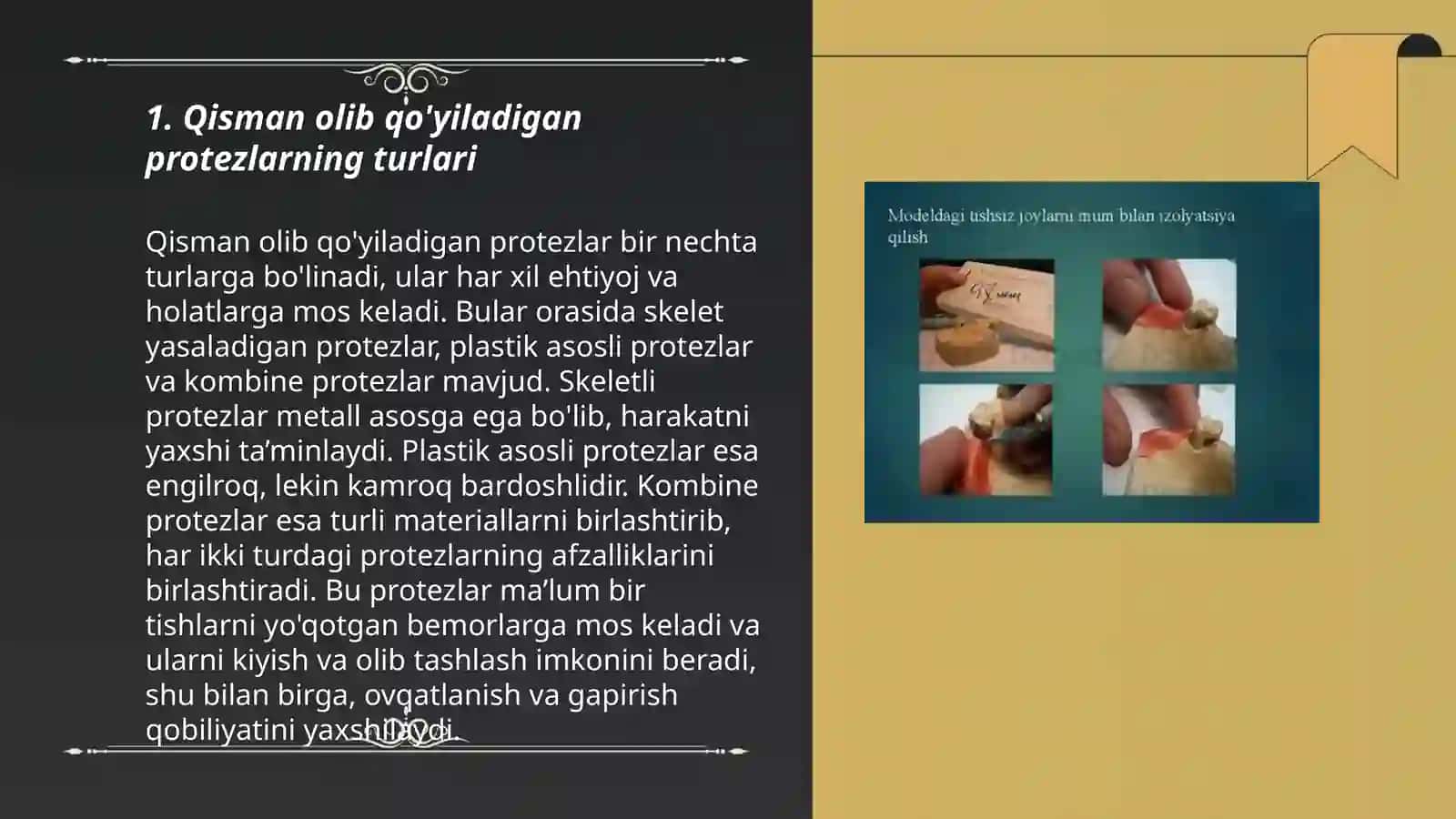 Qisman olib qo'yiladigan protezlarning turlari 3