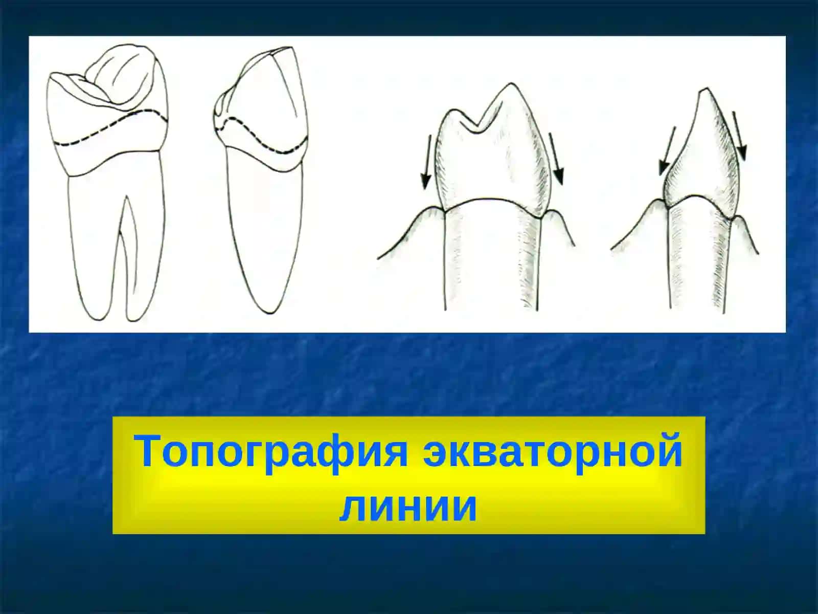 Строение зубных рядов, Окклюзия, Артикуляция. Виды прикусов 3