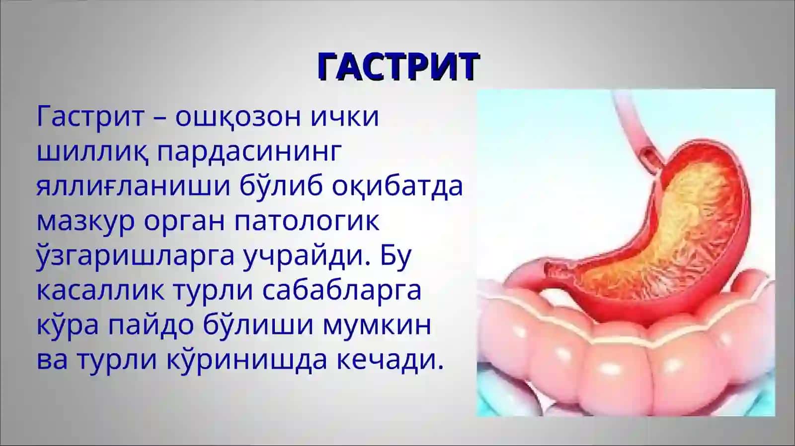 Болаларда гастрит ва гастродуоденитларнинг этиологияси, ташхисоти, клиник белгилари ва даволаш 3