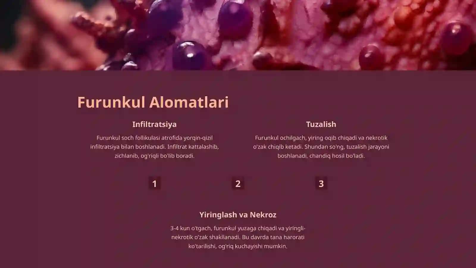 Furunkul (Chipqon) — Sabablari, Asoratlari, Tashxislash, Davolash, Oldini Olish 3