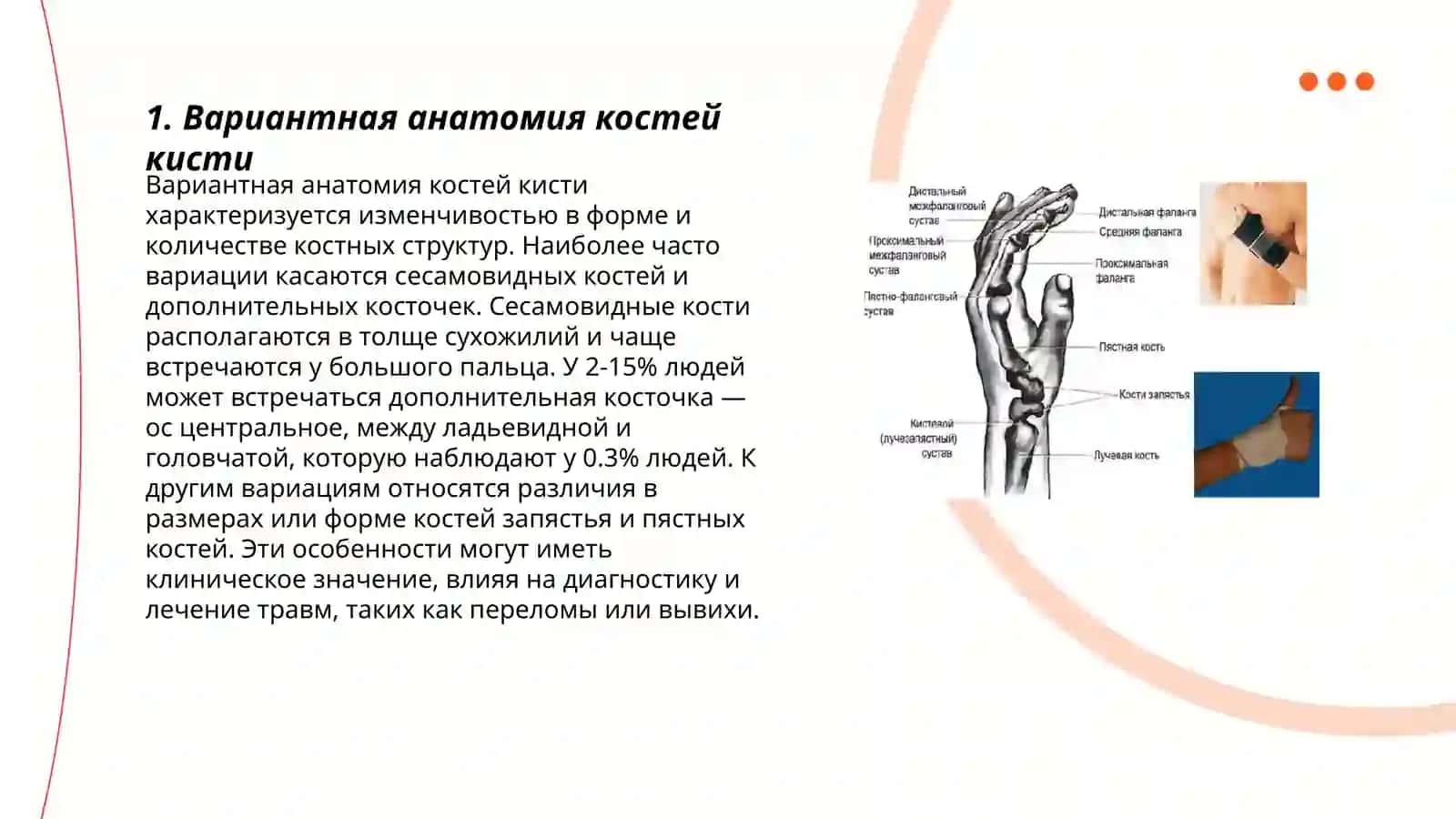 Вариантная анатомия костей кисти, пороки развития, влияние внутренних и внешних факторов на развитие костей кисти 3