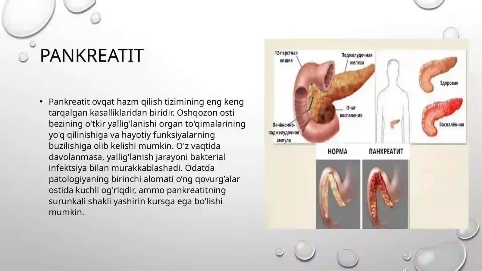 Pankreatit rivojlanishining biokimyoviy asoslari, davolash va diagnostika tamoyillari 3
