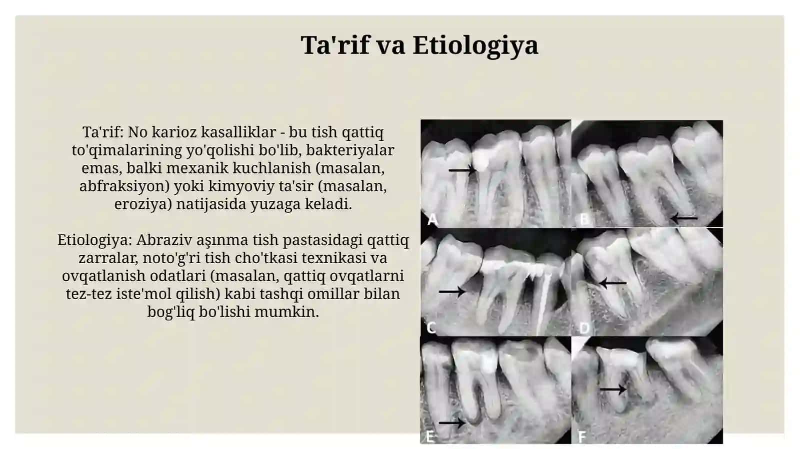Tish chiqqandan keyin paydo boladigan nokaries kasalliklar. Mexanik travma 3