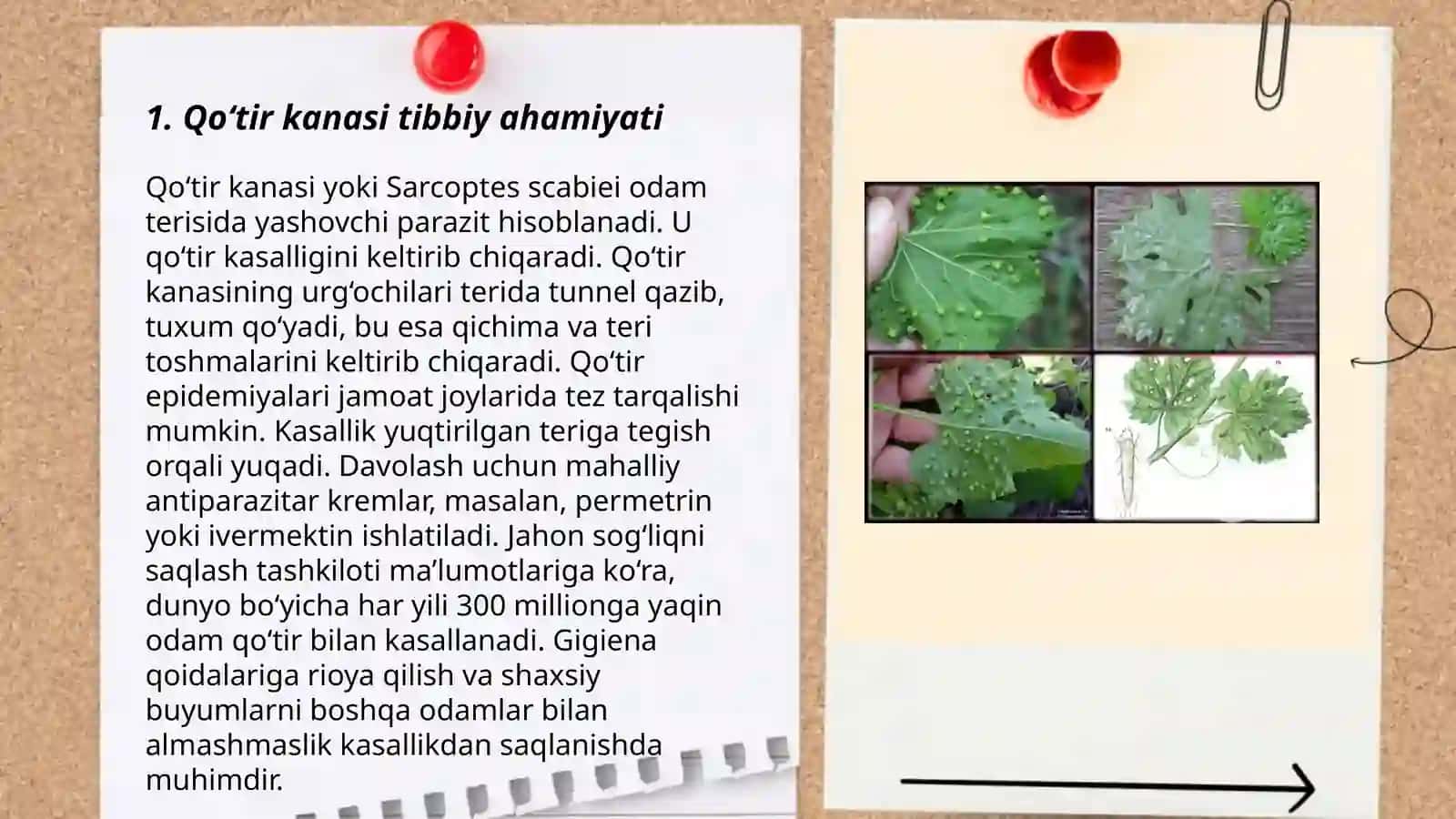 Tibbiy araxnoentomologiya:oʻrgimchaksimonlar:qoʻtir kana,ornitodorus kanasi,tayga kanasi,it kanasi 3