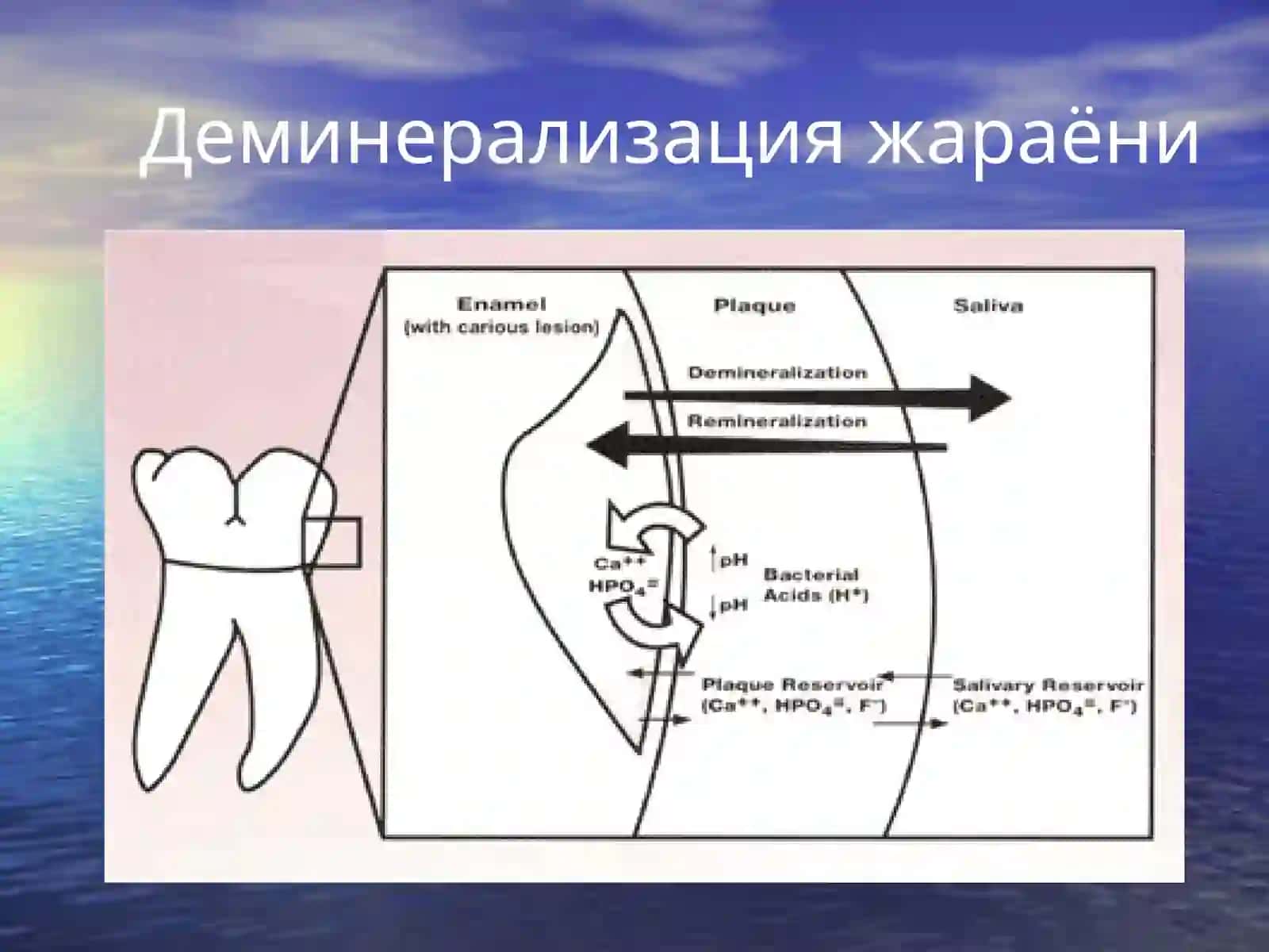 Кариес ҳақида тушунча 3