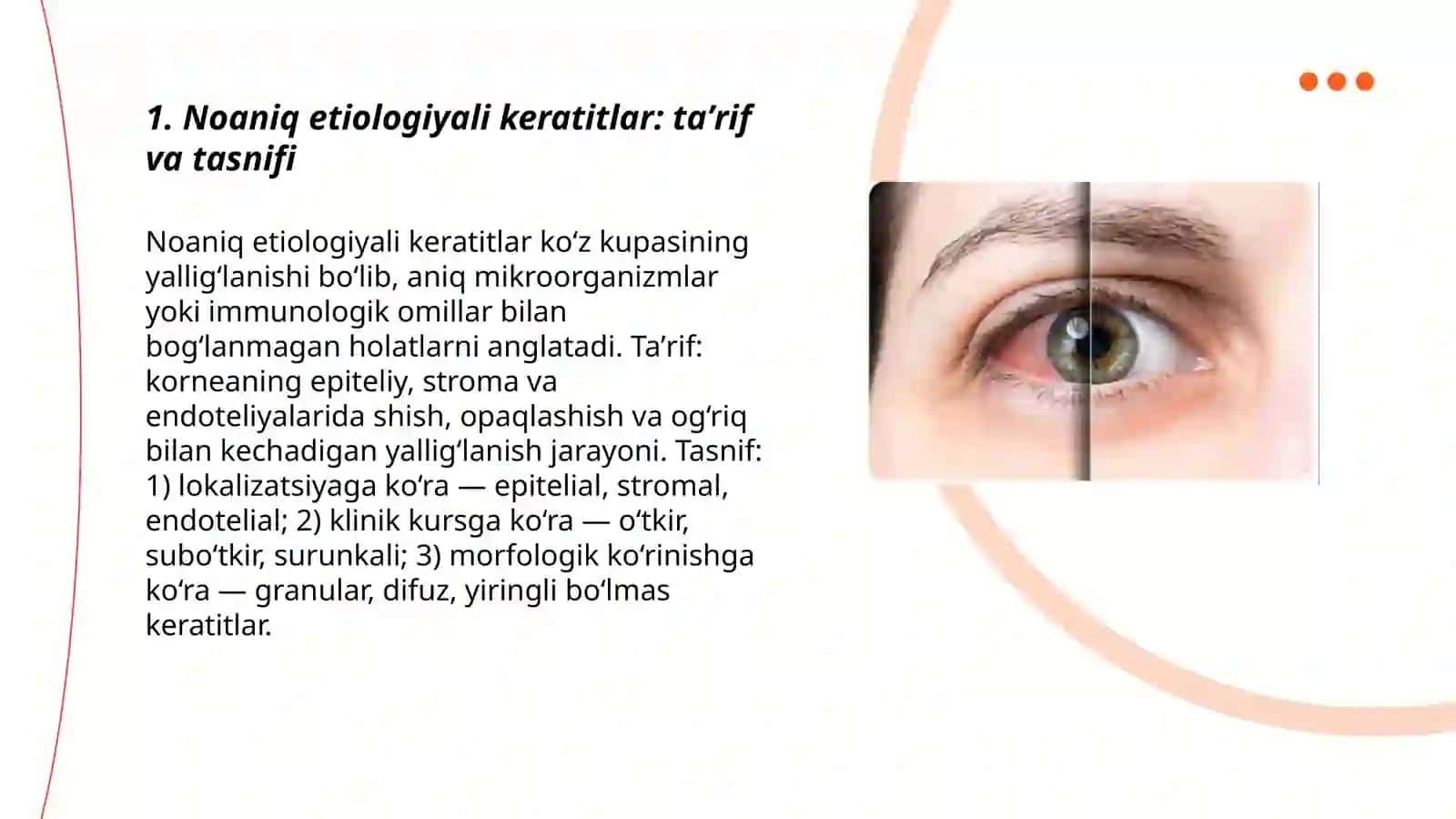 Noaniq etiologiyali keratitlar 3