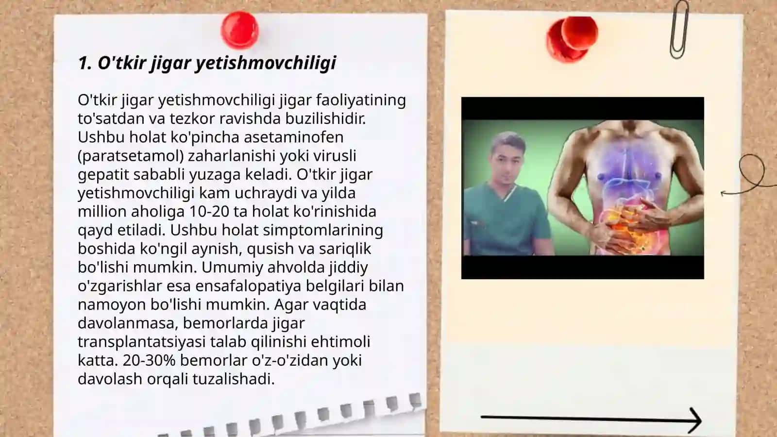 Jigar kasalliklarining kilinik simptomlari. Jigar yetishmovchiligi 3