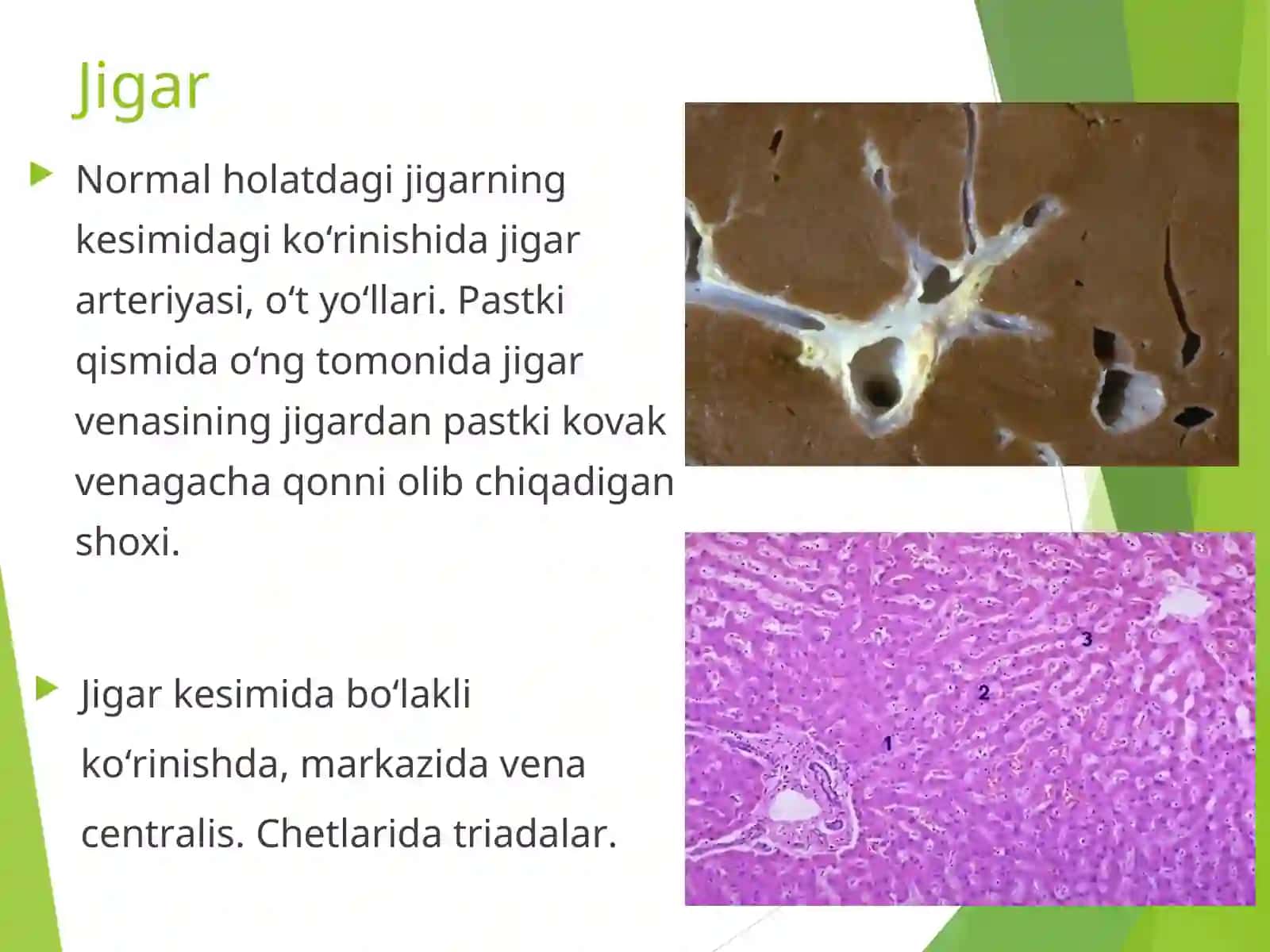 Jigar kasalliklari 3