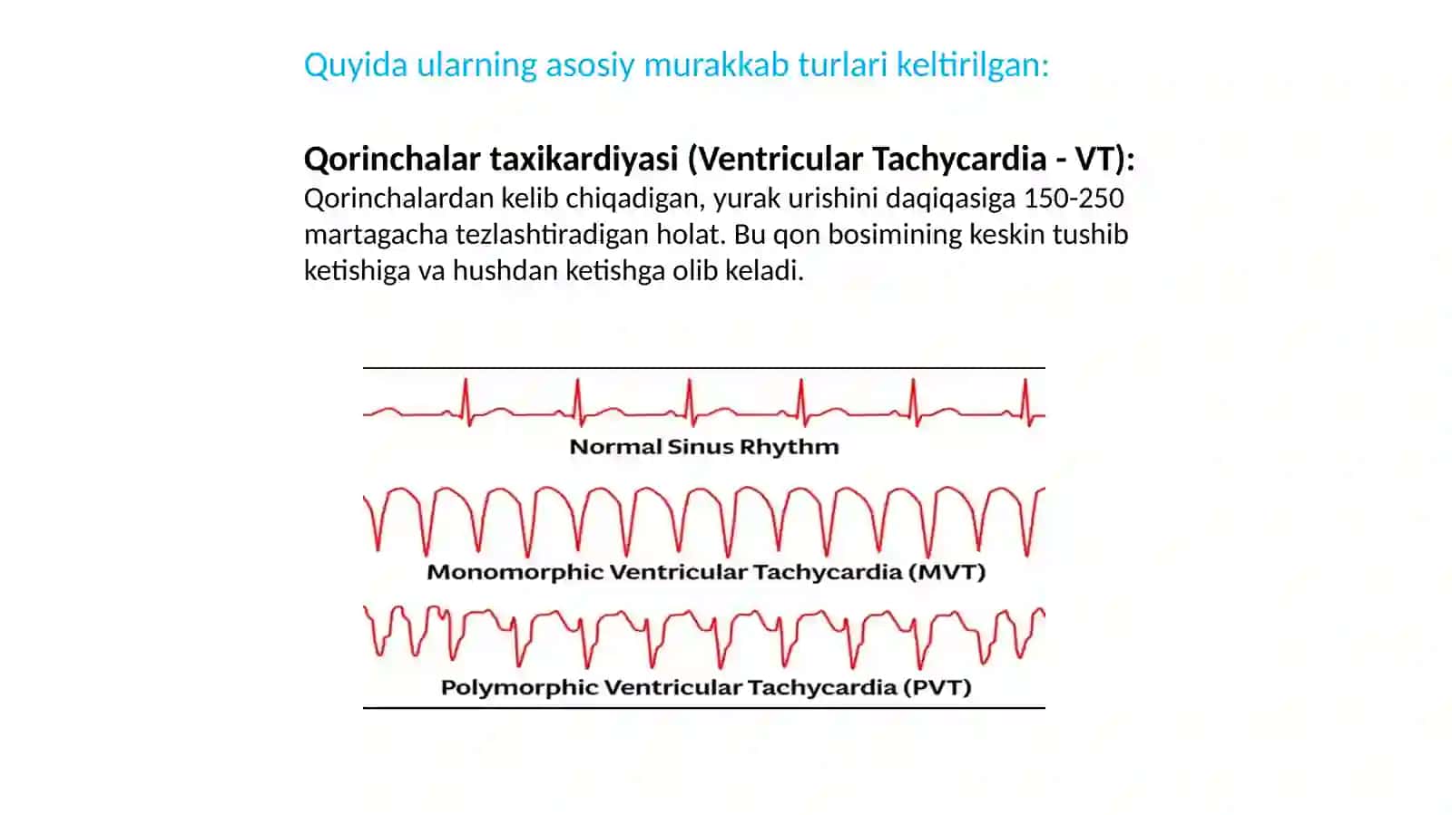 Yurak ritm buzilishi. Yurak o‘tkazuvchanligining buzilishi: Blokadalar. 3