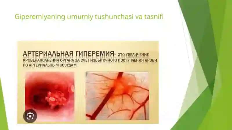 Arterial va venoz giperemiya 3