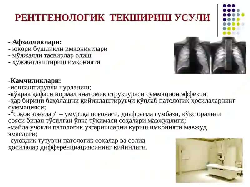 Нафас тизими аъзоларининг тиббий визуализацияси 3