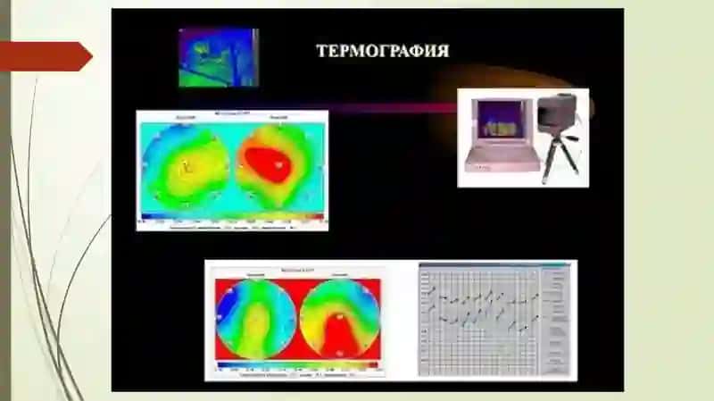 Radiologik(noionli) tekshiruv usullari, Termografiya 3