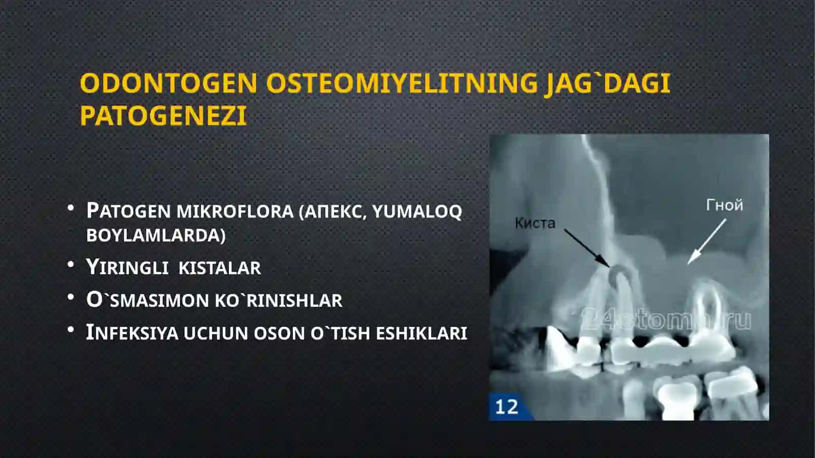 Surunkaliodontogenosteomiyelit 3