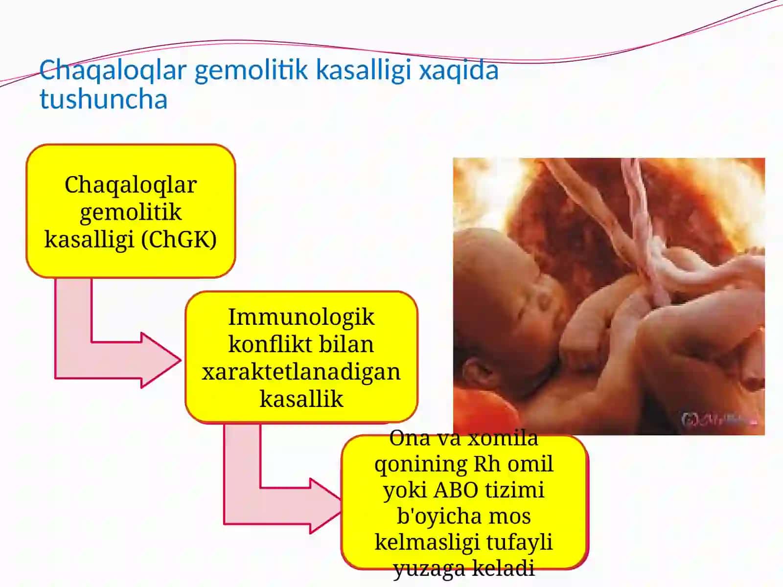 Chaqaloqlar gemolitik kasalligi (ChGK) xaqida tushuncha 3