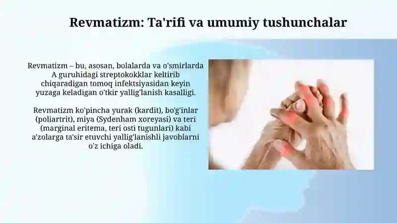 Revmatizm va revmatoid artrit. Seronegativ spondiloartritlarning diagnostik mezonlari 3