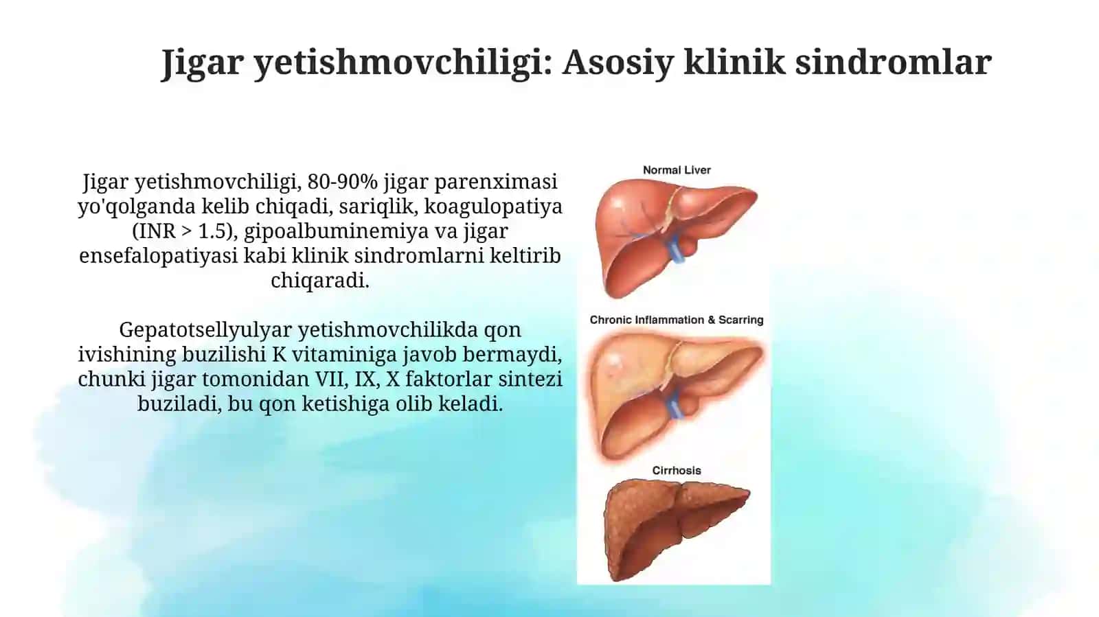 Jigar va ót yollari kasaliklari assosiy kilinik sindromlari 3