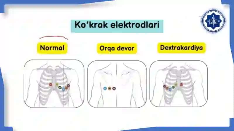Elektrokardiografiya 3