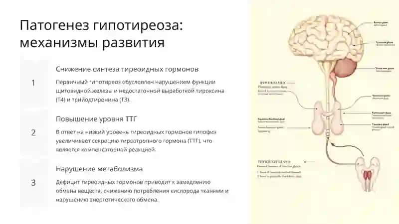 Гипотиреоз и йододефицитное состояние 3