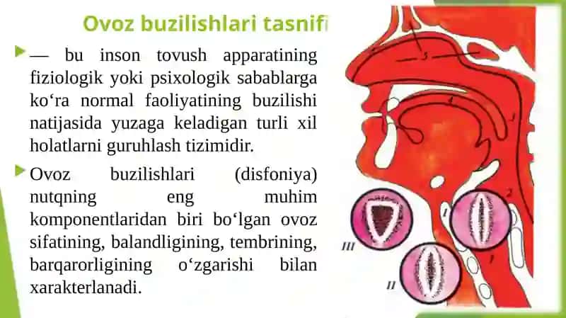 Ovozbuzilishining tasnifi 3
