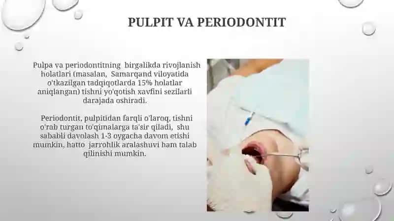 Pulpit va periodontit 3