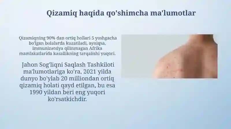 Qizamiq kasalligi 3