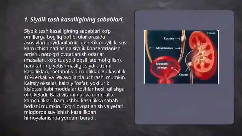 Siydik tosh kasalligi 3